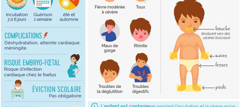 Infographie : maladie pieds-mains-bouche