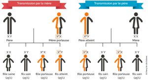 Maladie de Fabry : définition, symptômes et traitement