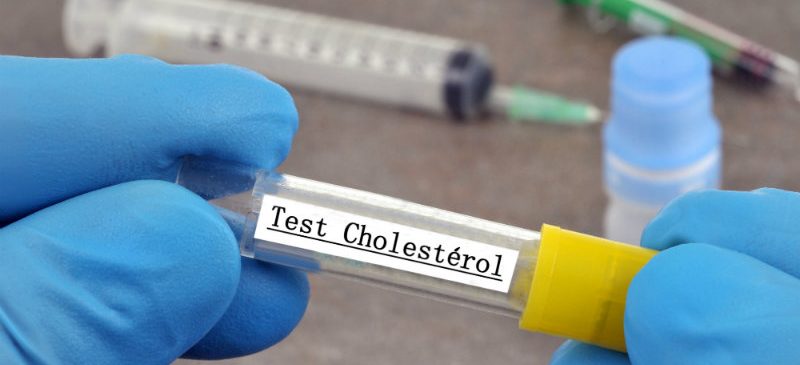 hypercholestérolémie - mesure du cholestérol