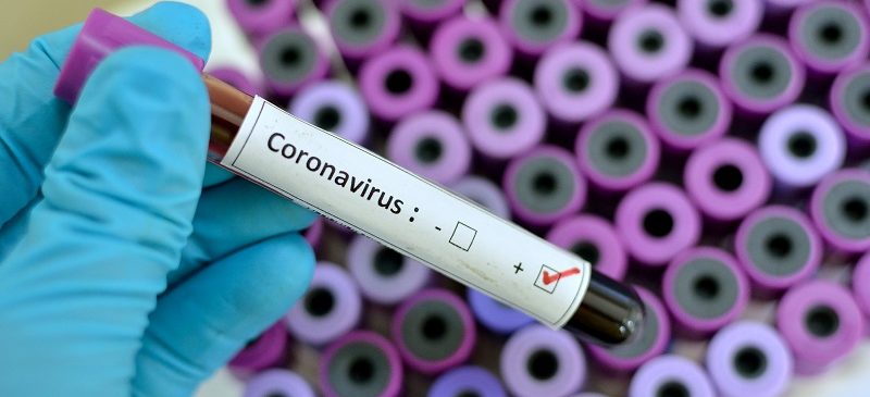 coronavirus